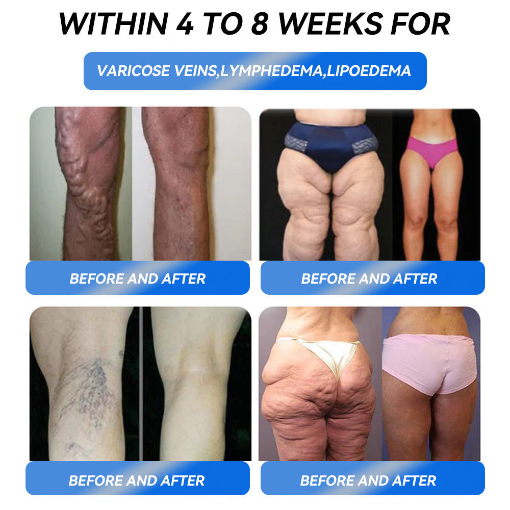 𝐈𝐅𝐌𝐀𝐆𝐈𝐂® 𝐆𝐋𝐏-𝟏 𝐏𝐫𝐨 𝐖𝐞𝐢𝐠𝐡𝐭 𝐋𝐨𝐬𝐬 𝐎𝐫𝐚𝐥 𝐒𝐨𝐥𝐮𝐭𝐢𝐨𝐧💧💧𝑂𝑛𝑒 𝑠𝑒𝑟𝑣𝑖𝑛𝑔 𝑝𝑒𝑟 𝑑𝑎𝑦 - 𝑟𝑒𝑠𝑢𝑙𝑡𝑠 𝑤𝑖𝑡ℎ𝑖𝑛 7 𝑑𝑎𝑦𝑠 ⏱️ 𝑆𝑢𝑖𝑡𝑎𝑏𝑙𝑒 𝑓𝑜𝑟 𝑜𝑏𝑒𝑠𝑖𝑡𝑦, 𝑐𝑎𝑟𝑑𝑖𝑜𝑣𝑎𝑠𝑐𝑢𝑙𝑎𝑟 𝑑𝑖𝑠𝑒𝑎𝑠𝑒, 𝑑𝑖𝑎𝑏𝑒𝑡𝑒𝑠, 𝑠𝑙𝑒𝑒𝑝 𝑎𝑝𝑛𝑒𝑎, ℎ𝑖𝑔ℎ 𝑐ℎ𝑜𝑙𝑒𝑠𝑡𝑒𝑟𝑜𝑙 𝑎𝑛𝑑 𝑏𝑙𝑜𝑜𝑑 𝑙𝑖𝑝𝑖𝑑𝑠, 𝑗𝑜𝑖𝑛𝑡 𝑝𝑟𝑜𝑏𝑙𝑒𝑚𝑠, 𝑎𝑛𝑑 𝑣𝑎𝑟𝑖𝑜𝑢𝑠 𝑜𝑡ℎ𝑒𝑟 𝑑𝑖𝑠𝑒𝑎𝑠𝑒𝑠💧