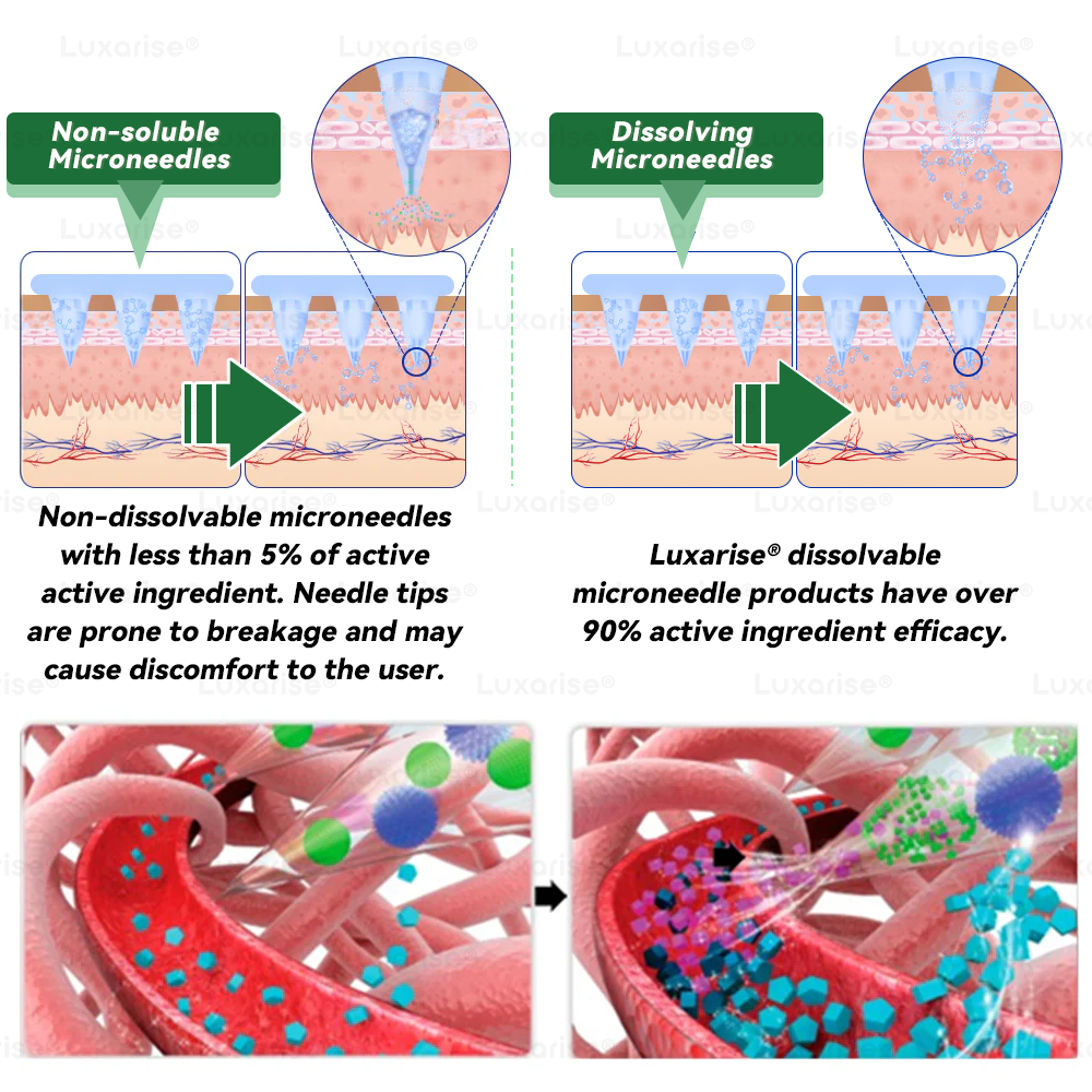 𝑶𝒇𝒇𝒊𝒄𝒊𝒂𝒍 𝑺𝒕𝒐𝒓𝒆 | 🍈💖𝑳𝒖𝒙𝒂𝒓𝒊𝒔𝒆® 𝑴𝒐𝒓𝒊𝒏𝒈𝒂 & 𝑩𝒆𝒓𝒃𝒆𝒓𝒊𝒏𝒆 10-𝑰𝑵-1 𝑨𝒅𝒗𝒂𝒏𝒄𝒆𝒅 𝑵𝒂𝒏𝒐 𝑴𝒊𝒄𝒓𝒐𝒏𝒆𝒆𝒅𝒍𝒆 𝑷𝒂𝒕𝒄𝒉 (𝐎𝐧𝐜𝐞 𝐃𝐚𝐢𝐥𝐲, 𝐯𝐢𝐬𝐢𝐛𝐥𝐞 𝐜𝐡𝐚𝐧𝐠𝐞𝐬 𝐢𝐧 𝟕 𝐝𝐚𝐲𝐬）✅ 𝐎𝐛𝐞𝐬𝐢𝐭𝐲, 𝐃𝐢𝐚𝐛𝐞𝐭𝐞𝐬, 𝐒𝐥𝐞𝐞𝐩 𝐀𝐩𝐧𝐞𝐚, 𝐀𝐧𝐝 𝐉𝐨𝐢𝐧𝐭 𝐈𝐬𝐬𝐮𝐞𝐬💥