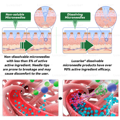 𝑶𝒇𝒇𝒊𝒄𝒊𝒂𝒍 𝑺𝒕𝒐𝒓𝒆 | 🍈💖𝑳𝒖𝒙𝒂𝒓𝒊𝒔𝒆® 𝑴𝒐𝒓𝒊𝒏𝒈𝒂 & 𝑩𝒆𝒓𝒃𝒆𝒓𝒊𝒏𝒆 10-𝑰𝑵-1 𝑨𝒅𝒗𝒂𝒏𝒄𝒆𝒅 𝑵𝒂𝒏𝒐 𝑴𝒊𝒄𝒓𝒐𝒏𝒆𝒆𝒅𝒍𝒆 𝑷𝒂𝒕𝒄𝒉 (𝐎𝐧𝐜𝐞 𝐃𝐚𝐢𝐥𝐲, 𝐯𝐢𝐬𝐢𝐛𝐥𝐞 𝐜𝐡𝐚𝐧𝐠𝐞𝐬 𝐢𝐧 𝟕 𝐝𝐚𝐲𝐬）✅ 𝐎𝐛𝐞𝐬𝐢𝐭𝐲, 𝐃𝐢𝐚𝐛𝐞𝐭𝐞𝐬, 𝐒𝐥𝐞𝐞𝐩 𝐀𝐩𝐧𝐞𝐚, 𝐀𝐧𝐝 𝐉𝐨𝐢𝐧𝐭 𝐈𝐬𝐬𝐮𝐞𝐬💥