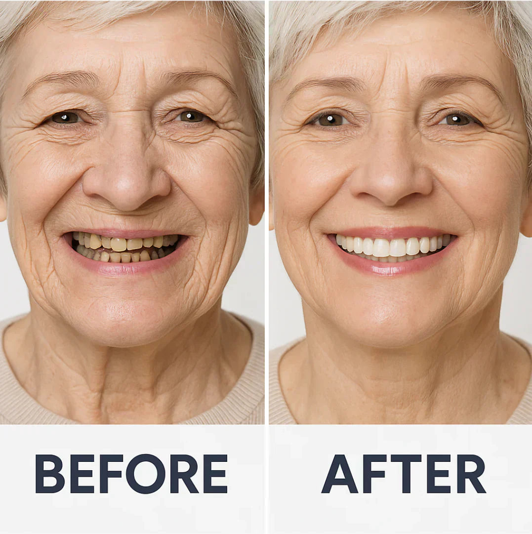 🦷 Jasseem® Custom-Fit Functional Dentures 😁 Smile with Confidence🍁💖
