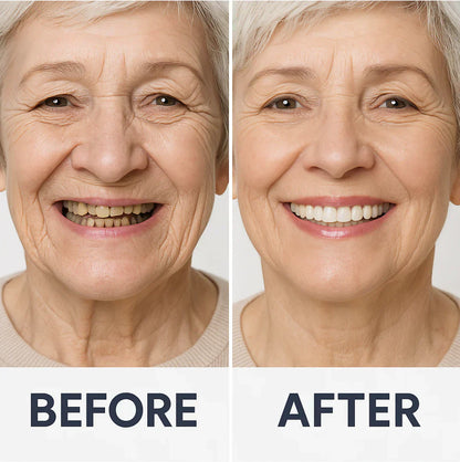 🦷 Jasseem® Custom-Fit Functional Dentures 😁 Smile with Confidence🍁💖