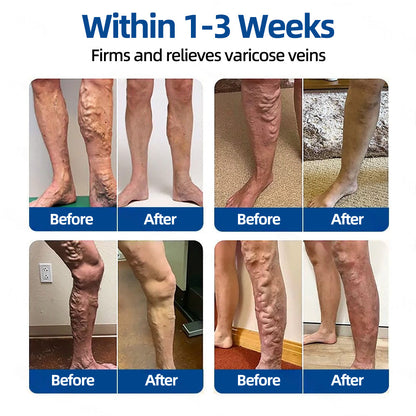 ✅𝐅𝐥𝐨𝐫𝐢𝐬𝐦𝐚®💐💖 𝐕𝐞𝐢𝐧𝐓𝐚𝐫𝐠𝐞𝐭 𝐌𝐢𝐜𝐫𝐨𝐧𝐞𝐞𝐝𝐥𝐞 𝐏𝐚𝐭𝐜𝐡⚡Instant Relief, Long-Term Results